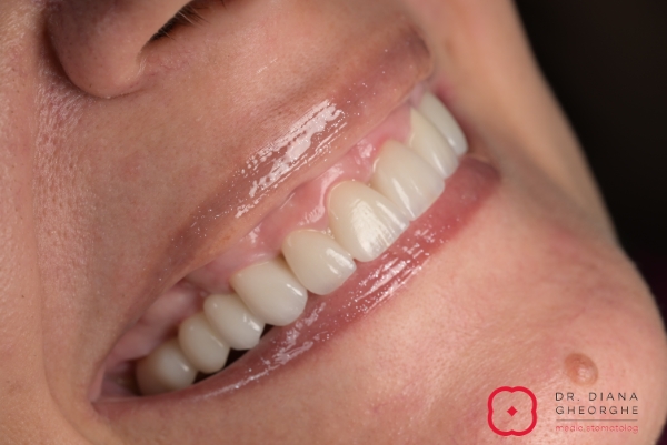 Estetică dentară