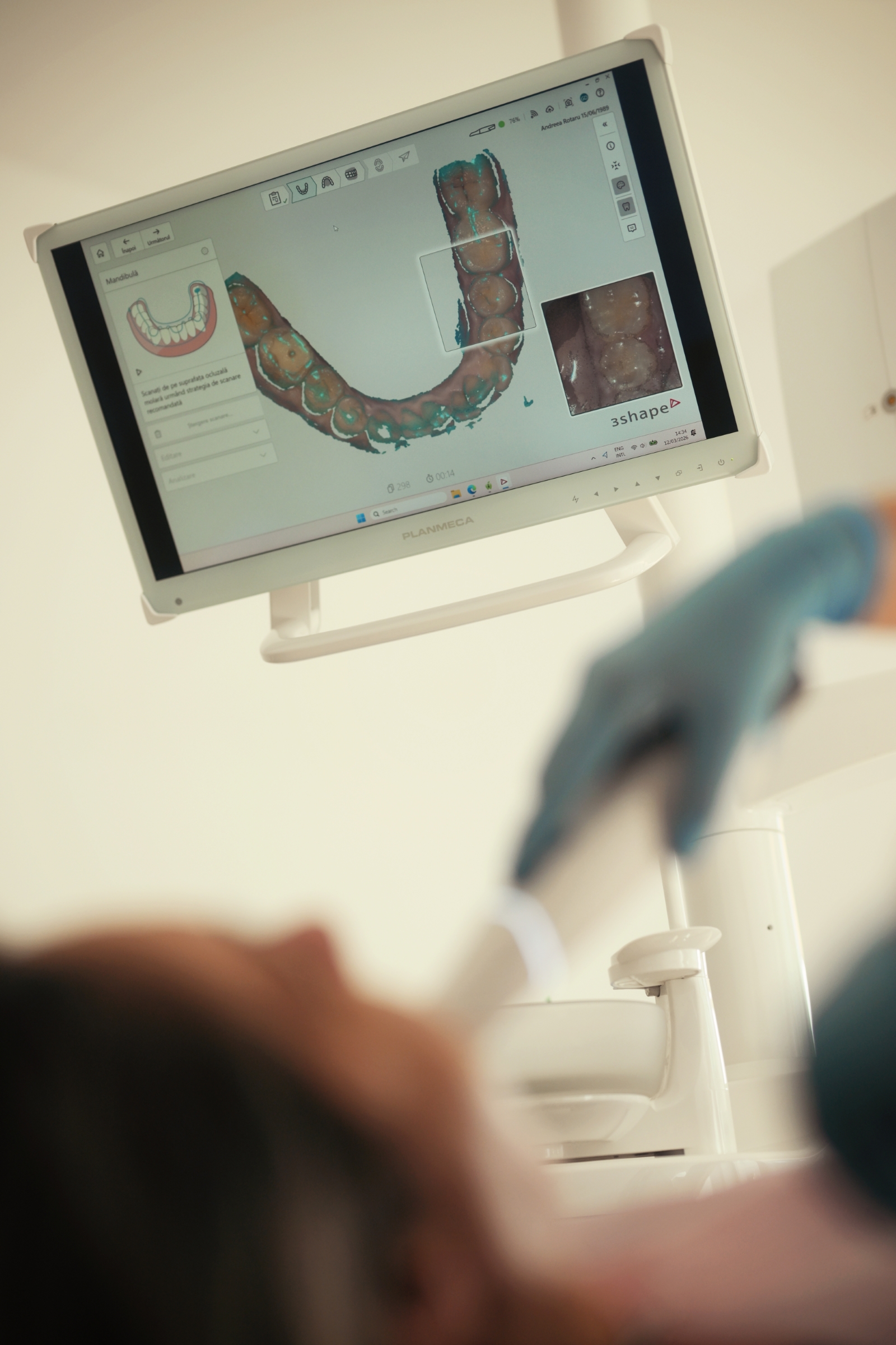 Scanner intraoral 3Shape TRIOS